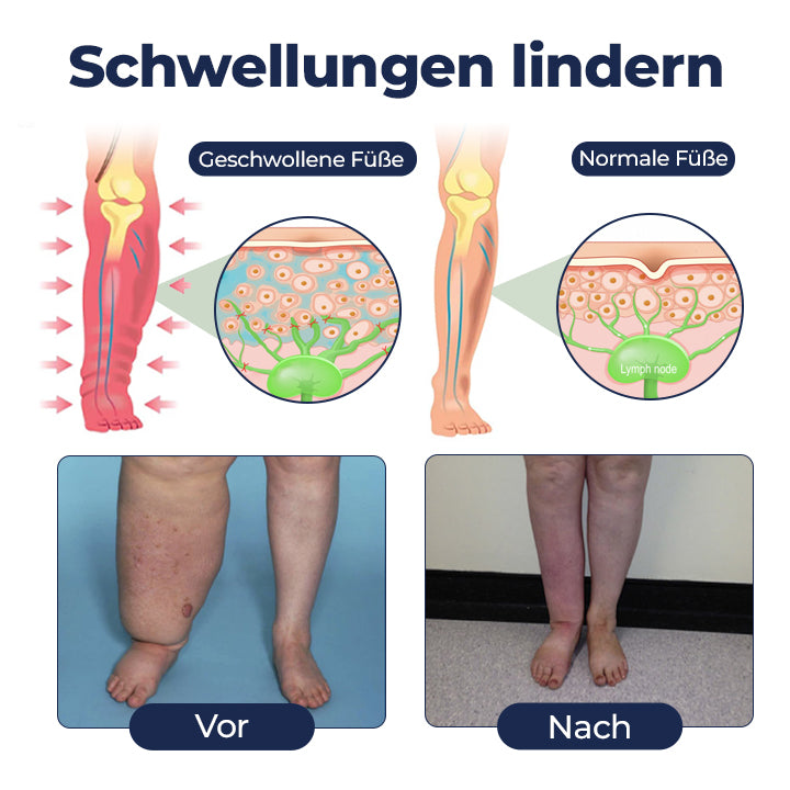 Timilk® SwellRelief Durchblutungsunterstützende Creme.