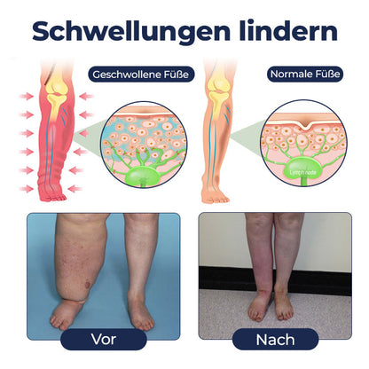 Timilk® SwellRelief Durchblutungsunterstützende Creme.