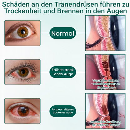 Ceoerty® OptiClear Nano Augenroller-Serum