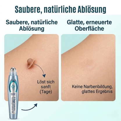 Timilk® SpotlessPro 7-Tage Fortschrittlicher Makel- & Hautanhängsel-Entferner