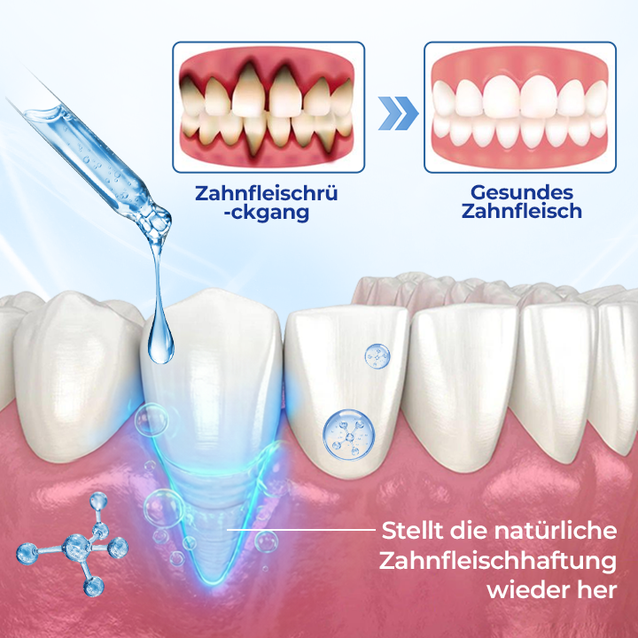 Biancat® BeeTakt Zahnfleisch-Repair Lösung.