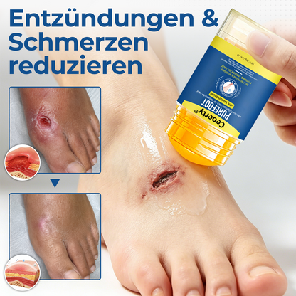Ceoerty® PureFoot Diabetes-Behandlungsstift