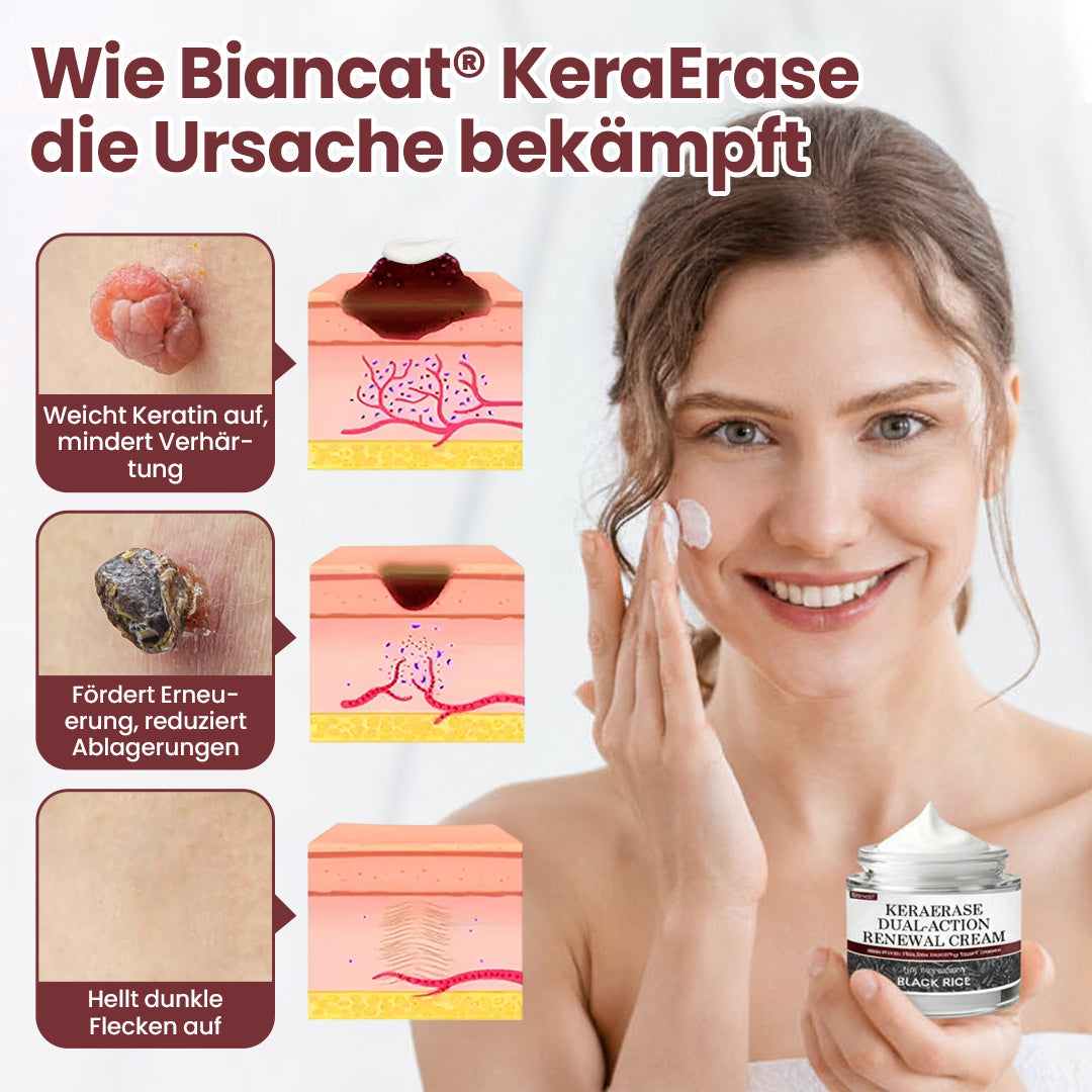 Biancat® KeraErase Dual-Action Erneuerungscreme.