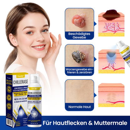 Timilk® ChillErase Erneuerungs-Spray gegen Hautunreinheiten
