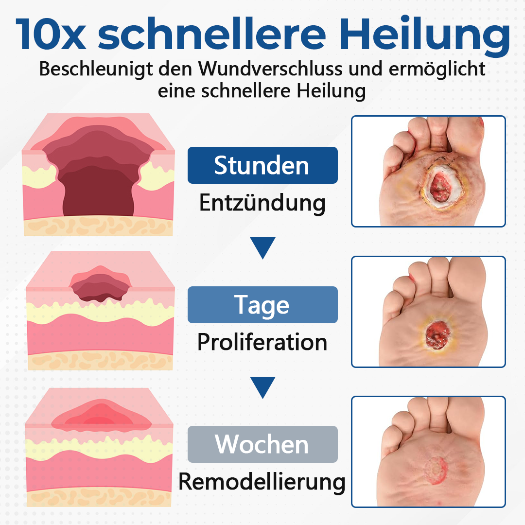 Ceoerty® PureFoot Diabetes-Behandlungsstift