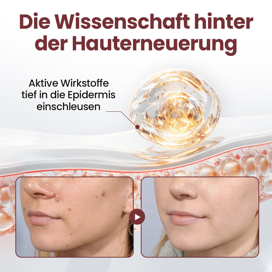 Biancat® KeraErase Dual-Action Erneuerungscreme.