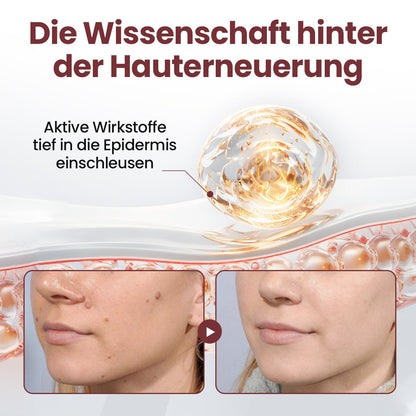 Biancat® KeraErase Dual-Action Erneuerungscreme.