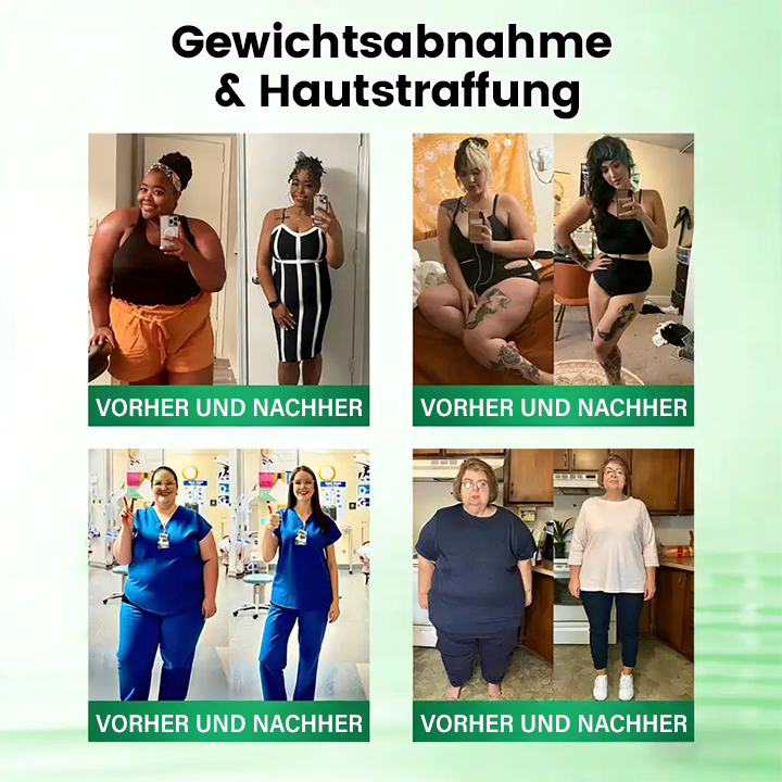 Offizieller Store | ☀️☀️ Timilk® Moringa · Berberin × NAD+ 10-in-1 Advanced Nano-Mikronadel-Patch GER (Nur einmal täglich anwenden – sichtbare Veränderungen in 7 Tagen)