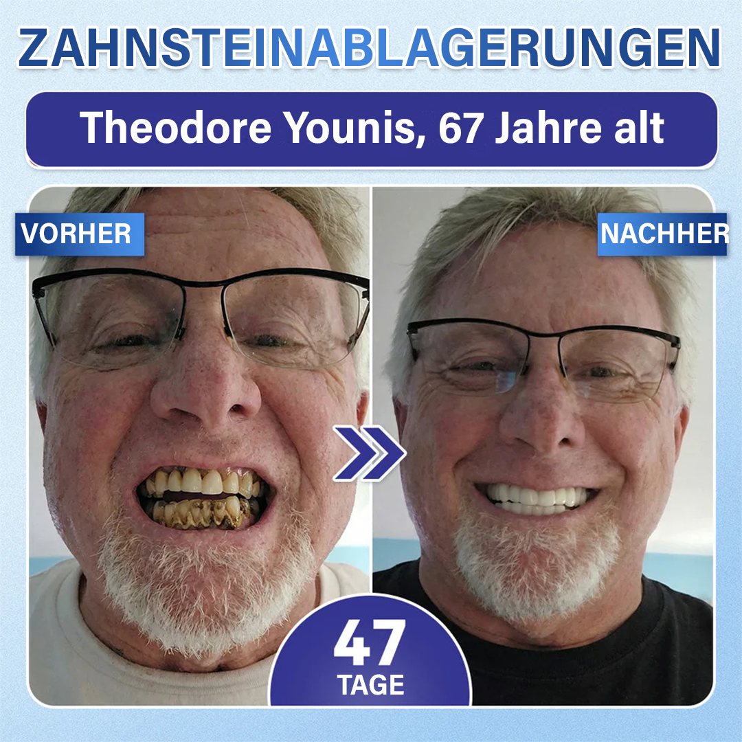 Dein Lächeln🦷Ceoerty® Zahn- und Zahnfleischpflege – schnell lösliches Mikronadel-Pflaster✨ (𝟓-𝐢𝐧-𝟏 💎 𝐙𝐚𝐡𝐧𝐬𝐜𝐡𝐦𝐞𝐥𝐳 & 𝐃𝐞𝐧𝐭𝐢𝐧 𝐖𝐢𝐞𝐝𝐞𝐫𝐚𝐮𝐟𝐛𝐚𝐮𝐞𝐧 • 𝐙𝐚𝐡𝐧𝐟𝐥𝐞𝐢𝐬𝐜𝐡 𝐒𝐭ä𝐫𝐤𝐞𝐧 • 𝐙𝐚𝐡𝐧𝐬𝐭𝐞𝐢𝐧 & 𝐌𝐮𝐧𝐝𝐠𝐞𝐫𝐮𝐜𝐡 𝐁𝐞𝐬𝐞𝐢𝐭𝐢𝐠𝐞𝐧 • 𝐙ä𝐡𝐧𝐞 𝐀𝐮𝐟𝐡𝐞𝐥𝐥𝐞𝐧 • 𝐙𝐚𝐡𝐧𝐞𝐦𝐩𝐟𝐢𝐧𝐝𝐥𝐢𝐜𝐡𝐤𝐞𝐢𝐭 𝐒𝐭𝐨𝐩𝐩𝐞𝐧)