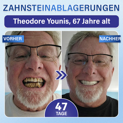 Dein Lächeln🦷Ceoerty® Zahn- und Zahnfleischpflege – schnell lösliches Mikronadel-Pflaster✨ (𝟓-𝐢𝐧-𝟏 💎 𝐙𝐚𝐡𝐧𝐬𝐜𝐡𝐦𝐞𝐥𝐳 & 𝐃𝐞𝐧𝐭𝐢𝐧 𝐖𝐢𝐞𝐝𝐞𝐫𝐚𝐮𝐟𝐛𝐚𝐮𝐞𝐧 • 𝐙𝐚𝐡𝐧𝐟𝐥𝐞𝐢𝐬𝐜𝐡 𝐒𝐭ä𝐫𝐤𝐞𝐧 • 𝐙𝐚𝐡𝐧𝐬𝐭𝐞𝐢𝐧 & 𝐌𝐮𝐧𝐝𝐠𝐞𝐫𝐮𝐜𝐡 𝐁𝐞𝐬𝐞𝐢𝐭𝐢𝐠𝐞𝐧 • 𝐙ä𝐡𝐧𝐞 𝐀𝐮𝐟𝐡𝐞𝐥𝐥𝐞𝐧 • 𝐙𝐚𝐡𝐧𝐞𝐦𝐩𝐟𝐢𝐧𝐝𝐥𝐢𝐜𝐡𝐤𝐞𝐢𝐭 𝐒𝐭𝐨𝐩𝐩𝐞𝐧)