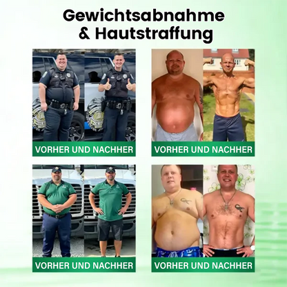 Offizieller Store | ☀️☀️ Timilk® Moringa · Berberin × NAD+ 10-in-1 Advanced Nano-Mikronadel-Patch GER (Nur einmal täglich anwenden – sichtbare Veränderungen in 7 Tagen)