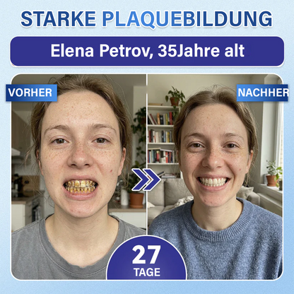 Dein Lächeln🦷Ceoerty® Zahn- und Zahnfleischpflege – schnell lösliches Mikronadel-Pflaster✨ (𝟓-𝐢𝐧-𝟏 💎 𝐙𝐚𝐡𝐧𝐬𝐜𝐡𝐦𝐞𝐥𝐳 & 𝐃𝐞𝐧𝐭𝐢𝐧 𝐖𝐢𝐞𝐝𝐞𝐫𝐚𝐮𝐟𝐛𝐚𝐮𝐞𝐧 • 𝐙𝐚𝐡𝐧𝐟𝐥𝐞𝐢𝐬𝐜𝐡 𝐒𝐭ä𝐫𝐤𝐞𝐧 • 𝐙𝐚𝐡𝐧𝐬𝐭𝐞𝐢𝐧 & 𝐌𝐮𝐧𝐝𝐠𝐞𝐫𝐮𝐜𝐡 𝐁𝐞𝐬𝐞𝐢𝐭𝐢𝐠𝐞𝐧 • 𝐙ä𝐡𝐧𝐞 𝐀𝐮𝐟𝐡𝐞𝐥𝐥𝐞𝐧 • 𝐙𝐚𝐡𝐧𝐞𝐦𝐩𝐟𝐢𝐧𝐝𝐥𝐢𝐜𝐡𝐤𝐞𝐢𝐭 𝐒𝐭𝐨𝐩𝐩𝐞𝐧)