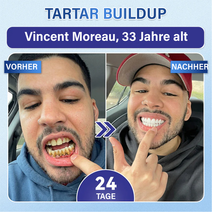 Dein Lächeln🦷Ceoerty® Zahn- und Zahnfleischpflege – schnell lösliches Mikronadel-Pflaster✨ (𝟓-𝐢𝐧-𝟏 💎 𝐙𝐚𝐡𝐧𝐬𝐜𝐡𝐦𝐞𝐥𝐳 & 𝐃𝐞𝐧𝐭𝐢𝐧 𝐖𝐢𝐞𝐝𝐞𝐫𝐚𝐮𝐟𝐛𝐚𝐮𝐞𝐧 • 𝐙𝐚𝐡𝐧𝐟𝐥𝐞𝐢𝐬𝐜𝐡 𝐒𝐭ä𝐫𝐤𝐞𝐧 • 𝐙𝐚𝐡𝐧𝐬𝐭𝐞𝐢𝐧 & 𝐌𝐮𝐧𝐝𝐠𝐞𝐫𝐮𝐜𝐡 𝐁𝐞𝐬𝐞𝐢𝐭𝐢𝐠𝐞𝐧 • 𝐙ä𝐡𝐧𝐞 𝐀𝐮𝐟𝐡𝐞𝐥𝐥𝐞𝐧 • 𝐙𝐚𝐡𝐧𝐞𝐦𝐩𝐟𝐢𝐧𝐝𝐥𝐢𝐜𝐡𝐤𝐞𝐢𝐭 𝐒𝐭𝐨𝐩𝐩𝐞𝐧)