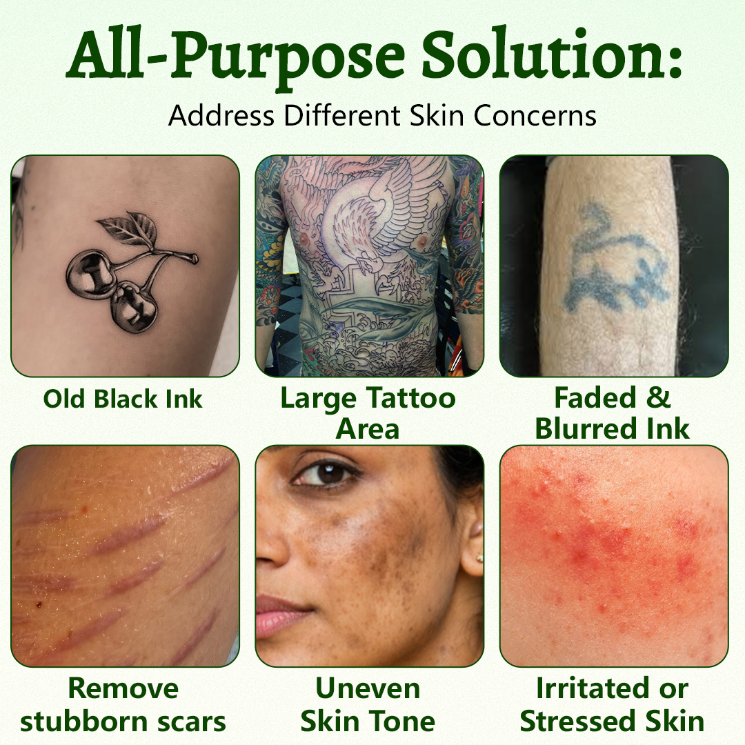 Ceoerty® PureAlgae Spray zur Unterstützung der Tattooentfernung 🌿.