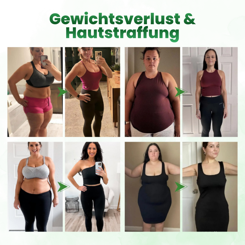 Timilk® SculptAura Moringa . Berberin + NAD+ 10-in-1 Nano-Mikronadel-Patch
