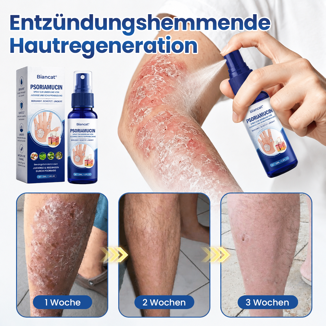 Biancat® PsoriaMucin Spray zur Linderung von Juckreiz und Schuppenbildung – ohne Reiben