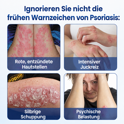 Biancat® PsoriaMucin Spray zur Linderung von Juckreiz und Schuppenbildung – ohne Reiben