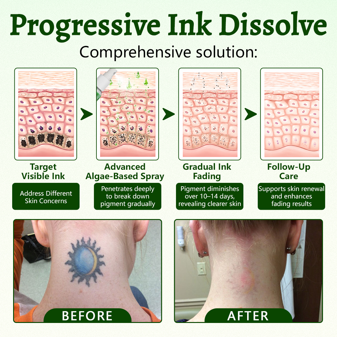 Ceoerty® PureAlgae Spray zur Unterstützung der Tattooentfernung 🌿.