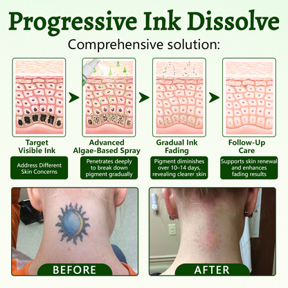Ceoerty® PureAlgae Spray zur Unterstützung der Tattooentfernung 🌿.