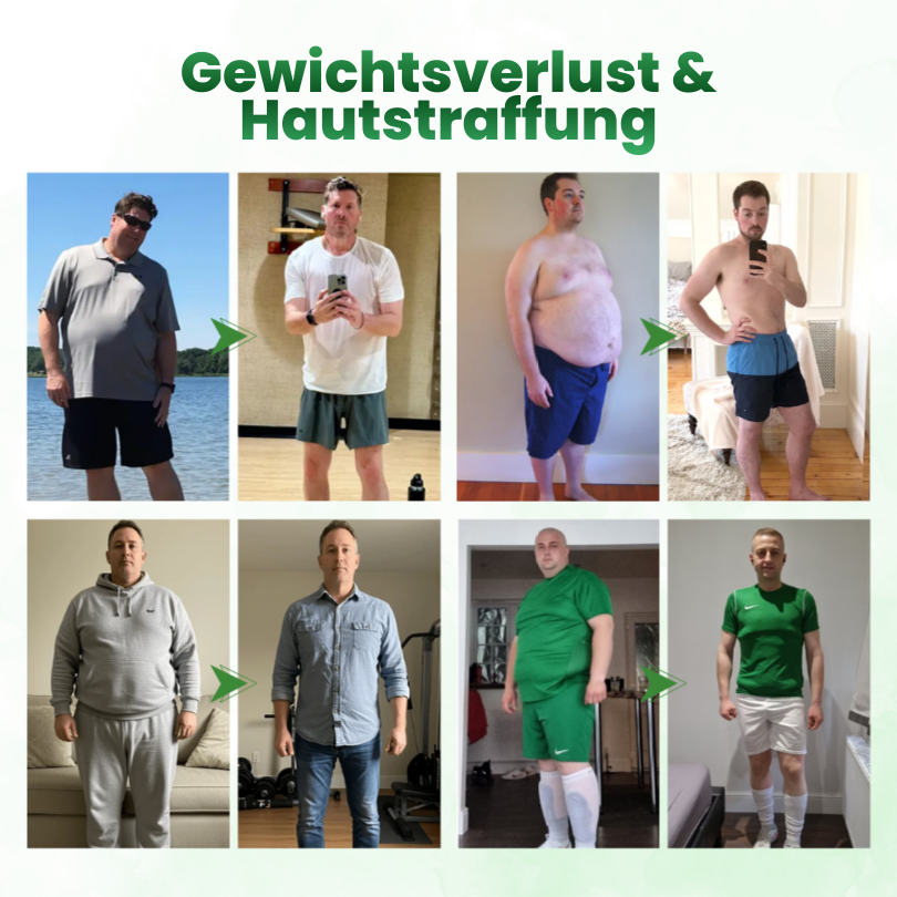 Timilk® SculptAura Moringa . Berberin + NAD+ 10-in-1 Nano-Mikronadel-Patch