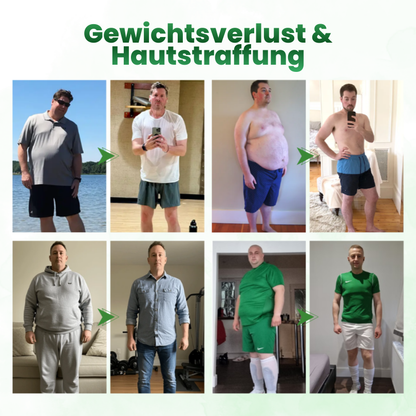 Timilk® SculptAura Moringa . Berberin + NAD+ 10-in-1 Nano-Mikronadel-Patch