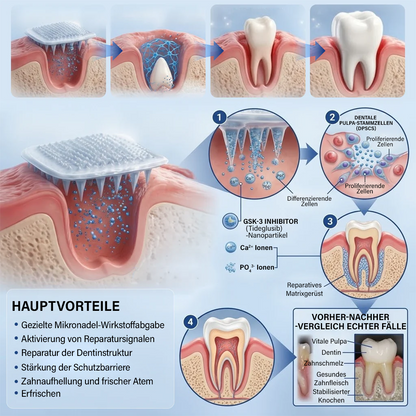 Dein Lächeln🦷Ceoerty® Zahn- und Zahnfleischpflege – schnell lösliches Mikronadel-Pflaster✨ (𝟓-𝐢𝐧-𝟏 💎 𝐙𝐚𝐡𝐧𝐬𝐜𝐡𝐦𝐞𝐥𝐳 & 𝐃𝐞𝐧𝐭𝐢𝐧 𝐖𝐢𝐞𝐝𝐞𝐫𝐚𝐮𝐟𝐛𝐚𝐮𝐞𝐧 • 𝐙𝐚𝐡𝐧𝐟𝐥𝐞𝐢𝐬𝐜𝐡 𝐒𝐭ä𝐫𝐤𝐞𝐧 • 𝐙𝐚𝐡𝐧𝐬𝐭𝐞𝐢𝐧 & 𝐌𝐮𝐧𝐝𝐠𝐞𝐫𝐮𝐜𝐡 𝐁𝐞𝐬𝐞𝐢𝐭𝐢𝐠𝐞𝐧 • 𝐙ä𝐡𝐧𝐞 𝐀𝐮𝐟𝐡𝐞𝐥𝐥𝐞𝐧 • 𝐙𝐚𝐡𝐧𝐞𝐦𝐩𝐟𝐢𝐧𝐝𝐥𝐢𝐜𝐡𝐤𝐞𝐢𝐭 𝐒𝐭𝐨𝐩𝐩𝐞𝐧)