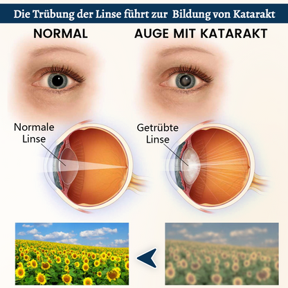 Ceoerty® OptiFusion Vision Support Augenpflaster👁️✨