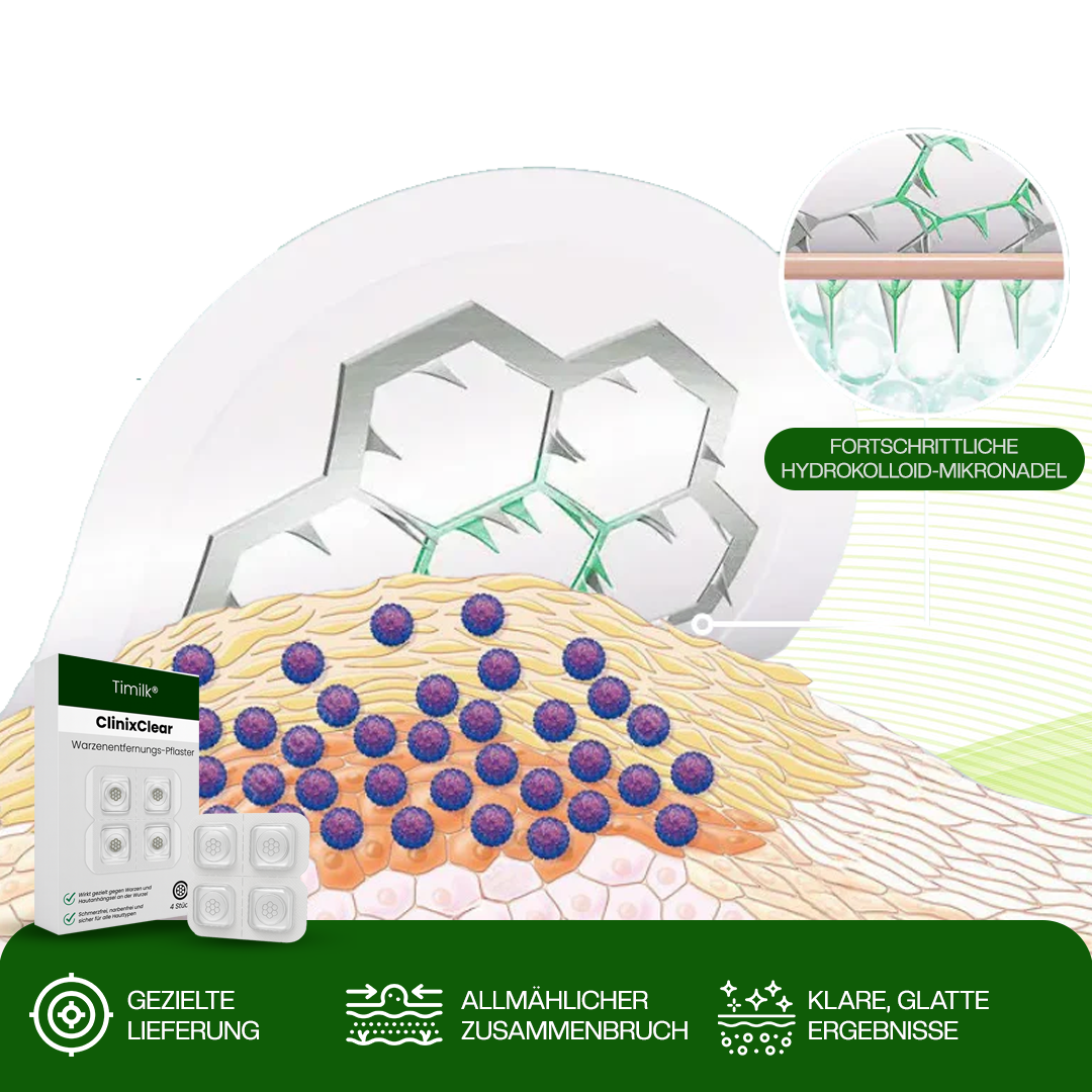 Timilk® ClinixClear Warzenentfernungs-Pflaster.