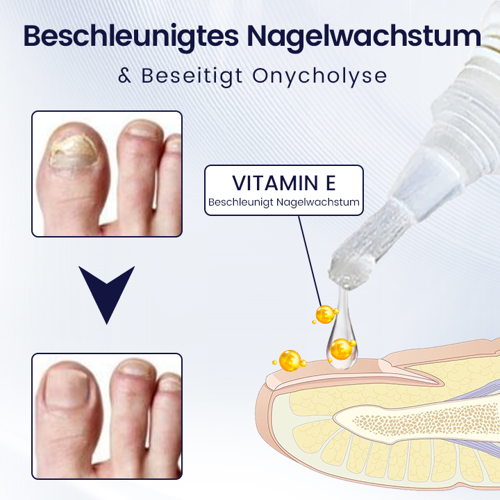 Ceoerty™ All-in-One-Nagelstärkungs-Essenzstift.