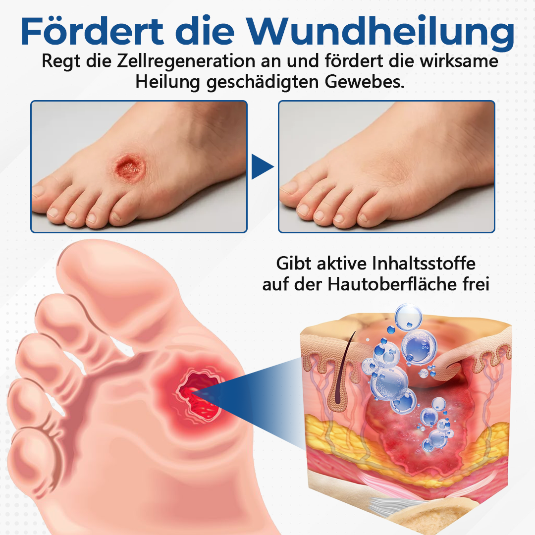 Ceoerty® PureFoot Diabetes-Behandlungsstift