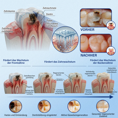 Dein Lächeln🦷Ceoerty® Zahn- und Zahnfleischpflege – schnell lösliches Mikronadel-Pflaster✨ (𝟓-𝐢𝐧-𝟏 💎 𝐙𝐚𝐡𝐧𝐬𝐜𝐡𝐦𝐞𝐥𝐳 & 𝐃𝐞𝐧𝐭𝐢𝐧 𝐖𝐢𝐞𝐝𝐞𝐫𝐚𝐮𝐟𝐛𝐚𝐮𝐞𝐧 • 𝐙𝐚𝐡𝐧𝐟𝐥𝐞𝐢𝐬𝐜𝐡 𝐒𝐭ä𝐫𝐤𝐞𝐧 • 𝐙𝐚𝐡𝐧𝐬𝐭𝐞𝐢𝐧 & 𝐌𝐮𝐧𝐝𝐠𝐞𝐫𝐮𝐜𝐡 𝐁𝐞𝐬𝐞𝐢𝐭𝐢𝐠𝐞𝐧 • 𝐙ä𝐡𝐧𝐞 𝐀𝐮𝐟𝐡𝐞𝐥𝐥𝐞𝐧 • 𝐙𝐚𝐡𝐧𝐞𝐦𝐩𝐟𝐢𝐧𝐝𝐥𝐢𝐜𝐡𝐤𝐞𝐢𝐭 𝐒𝐭𝐨𝐩𝐩𝐞𝐧)
