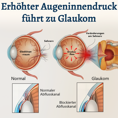 Ceoerty® OptiFusion Vision Support Augenpflaster👁️✨