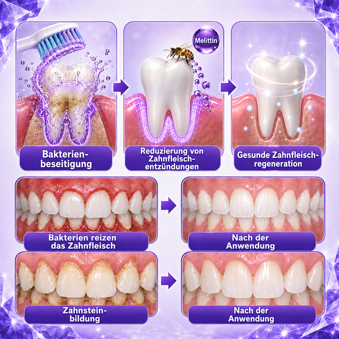 Ceoerty® Gingivitis & Parodontitis Pflege-Zahnpasta