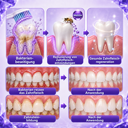 Ceoerty® Gingivitis & Parodontitis Pflege-Zahnpasta