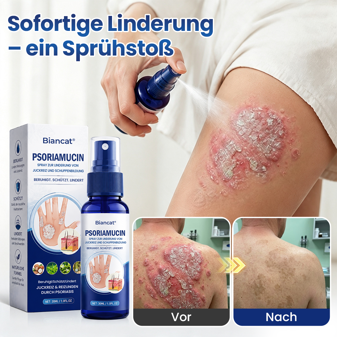 Biancat® PsoriaMucin Spray zur Linderung von Juckreiz und Schuppenbildung – ohne Reiben