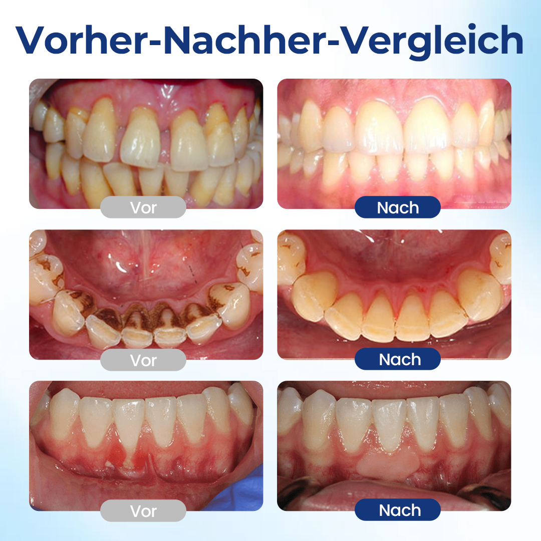 Biancat® BeeTakt Zahnfleisch-Repair Lösung.