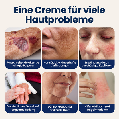 Biancat® ResiliVeil Barriere-Pflegecreme gegen blaue Flecken.