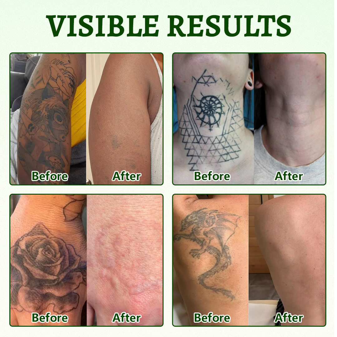 Ceoerty® PureAlgae Spray zur Unterstützung der Tattooentfernung 🌿.
