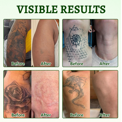 Ceoerty® PureAlgae Spray zur Unterstützung der Tattooentfernung 🌿.