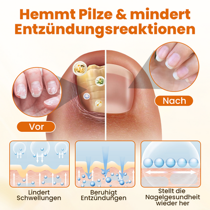 Timilk® FungiBee Fortschrittliches Nagelreparatur-Spray.
