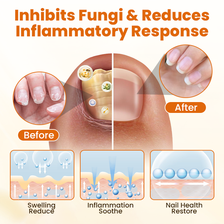 Timilk® FungiBee Fortschrittliches Nagelreparatur-Spray