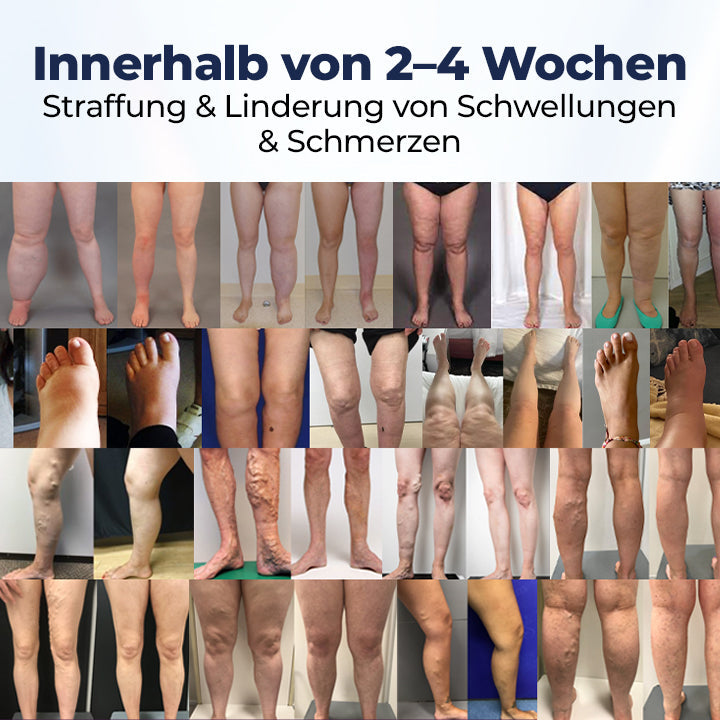 Timilk® SwellRelief Durchblutungsunterstützende Creme.