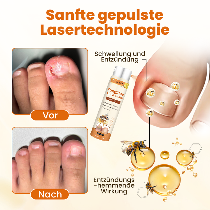 Timilk® FungiBee Fortschrittliches Nagelreparatur-Spray.