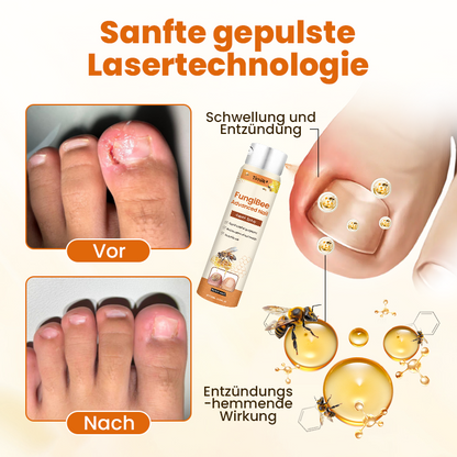 Timilk® FungiBee Fortschrittliches Nagelreparatur-Spray.