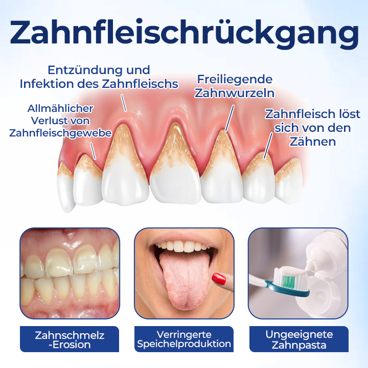 Biancat® BeeTakt Zahnfleisch-Repair Lösung.