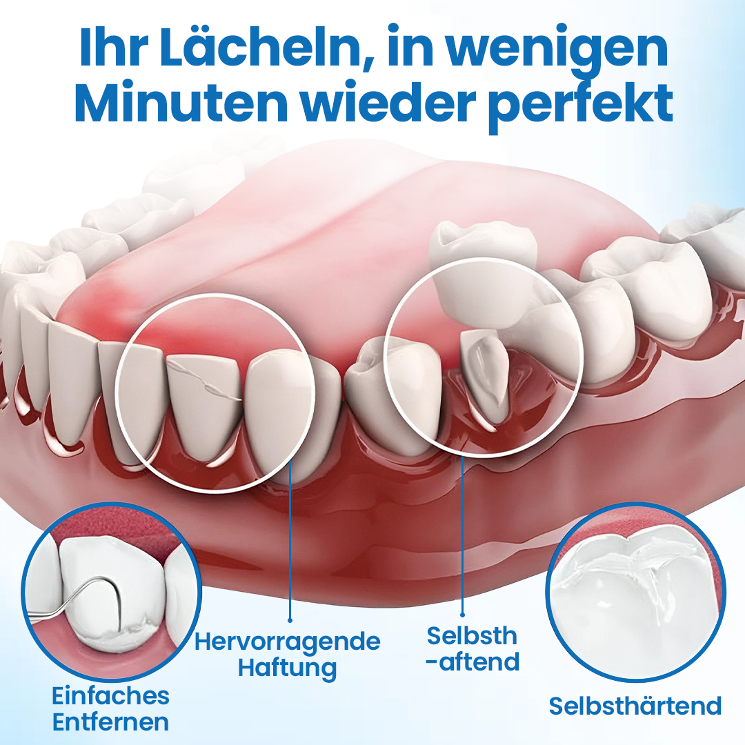 Timilk® SmileMend Zahnreparatur-Füllungsset